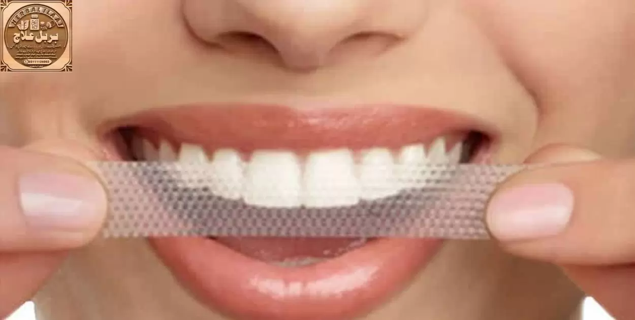 Are Crest Teeth Whitening Strips As Effective As Other Top Brands?